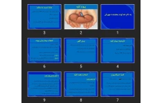 پاورپوینت پیوند کلیه