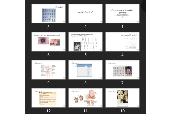 پاورپوینت Chromosome disorders (Part2)