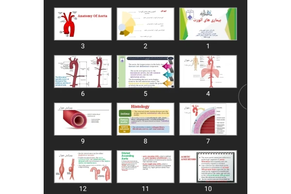 پاورپوینت بیماری های آئورت