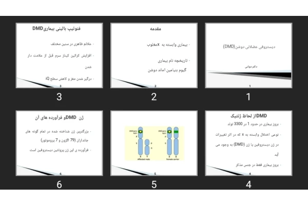 پاورپوینت دیستروفی عضلانی دوشن DMD