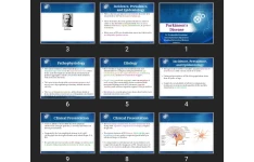 پاورپوینت Parkinson’s Disease