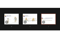 جزوه Osteology of distal upper limb