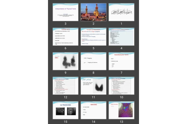 پاورپوینت تفسیر تیروئید Interpretation of Thyroid Tests