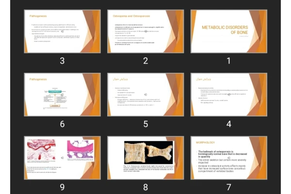 پاورپوینت METABOLIC DISORDERS OF BONE