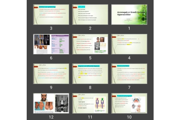 پاورپوینت Acromegaly or Growth Hormone Hypersecretion