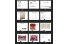پاورپوینت Respiratory Tract Infection (RTI)