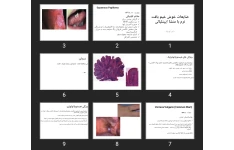 پاورپوینت ضایعات خوش خیم بافت نرم با منشا اپیتلیالی
