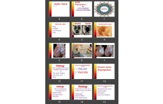 پاورپوینت Aortic Regurgitation