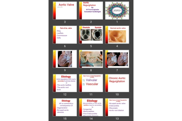 پاورپوینت Aortic Regurgitation