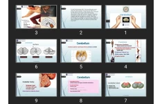 پاورپوینت Cerebellum