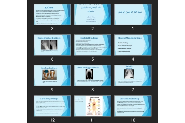 پاورپوینت ریکتز در کودکان و تاثیر بیماری های گوارشی در متابولیزم استخوان