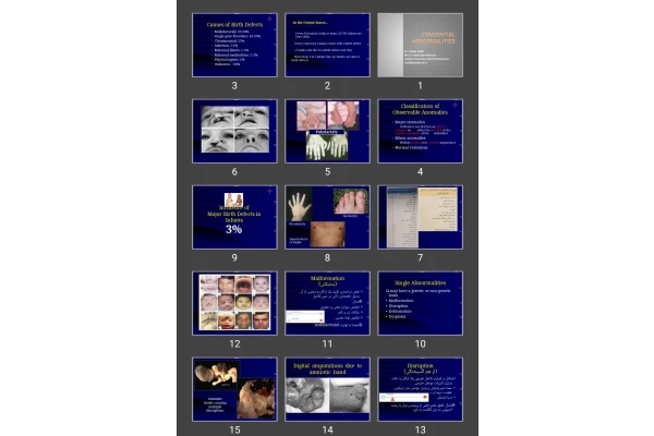 پاورپوینت Congenital abnormalities