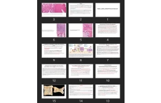 پاورپوینت Bones, Joints, and Soft Tissue Tumors21