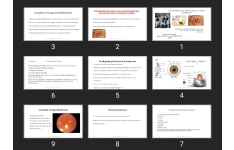 پاورپوینت دو بیماری سطحی قارچی (کراتومایکوزیس و  اتومایکوزیس)