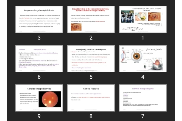 پاورپوینت دو بیماری سطحی قارچی (کراتومایکوزیس و  اتومایکوزیس)