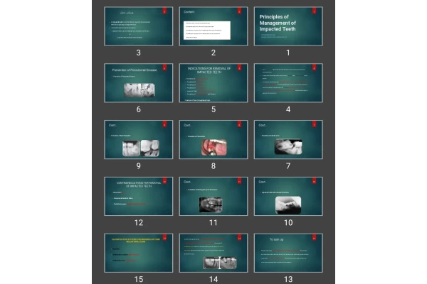 پاورپوینت Principles of Management of Impacted Teeth