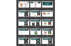 پاورپوینت سکته مغزی و خونرسانی مغز Cerebral vascular territories