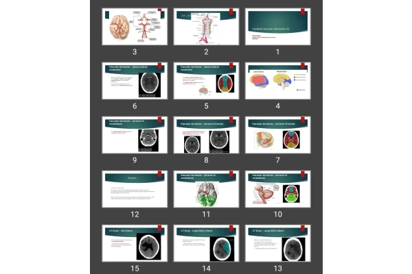 پاورپوینت سکته مغزی و خونرسانی مغز Cerebral vascular territories