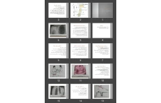 پاورپوینت Upper extremity