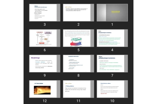 پاورپوینت General pathology Hemodynamic Disorders1