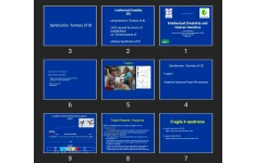 پاورپوینت Intellectual Disability and Human Genetics