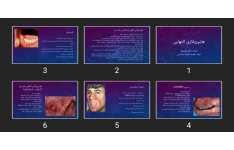 پاورپوینت هایپرپلازی التهابی