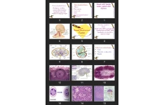 پاورپوینت  Diseases of white blood cells, lymph nodes ,spleen and thymus