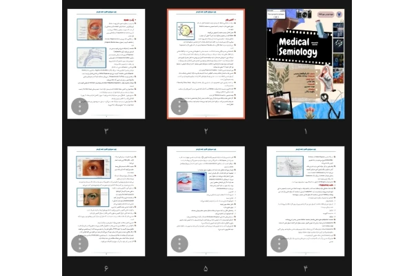 جزوه سمیولوژی مبحث چشم