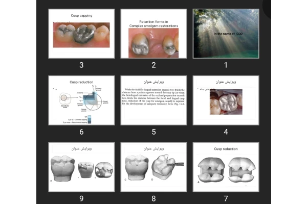 پاورپوینت Retention forms in Complex amalgam restorations