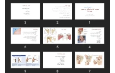 پاورپوینت معاینه اندام فوقانی و ستون مهره ها