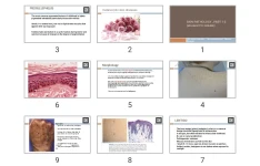پاورپوینت Skin Pathology , part 1-2 (Melanocytic disease)
