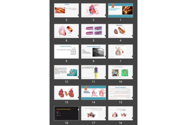 پاورپوینت Coronary Artery Bypass Grafting (CABG)