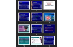 پاورپوینت Pulmonary Tuberculosis