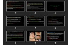 پاورپوینت Inflammatory Myopathies
