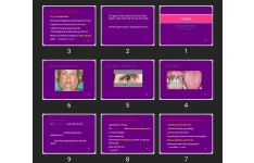 پاورپوینت شوگرن Sjogren