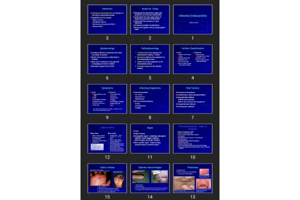 پاورپوینت Infective Endocarditis
