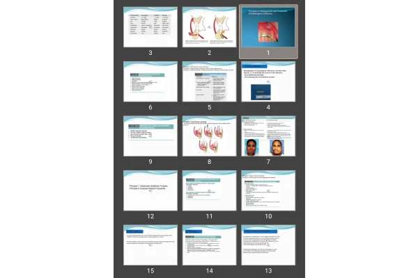 پاورپوینت Principles of Management and Prevention of Odontogenic Infections