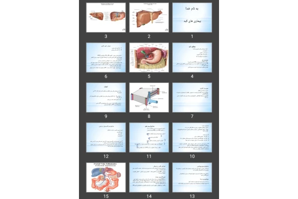 پاورپوینت بیماری های کبد