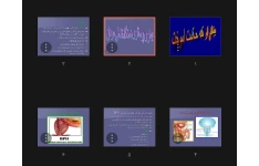 جزوه بیماری پرستاری دستگاه تناسلی مردان