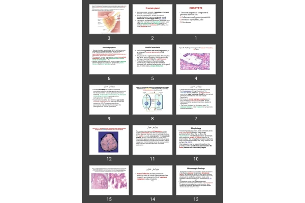 پاورپوینت PROSTATE