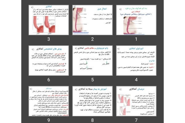 پاورپوینت اختلالات مری (آشالازی، دیورتیکول، ریفلاکس، تومورهای مری)