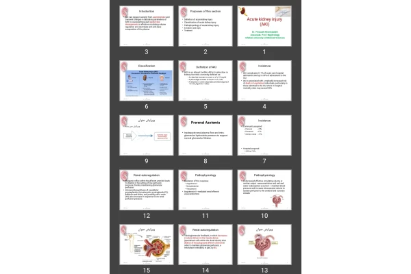 پاورپوینت Acute kidney injury (AKI)