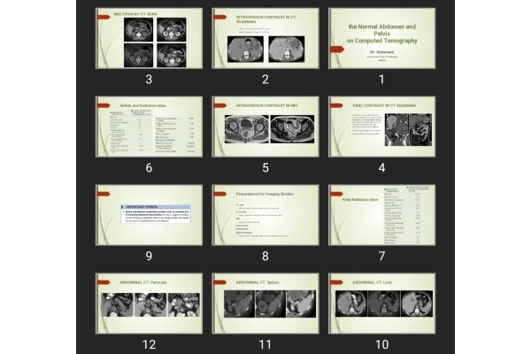 پاورپوینت the Normal Abdomen and Pelvis on Computed Tomography