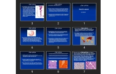 اورپوینت Gastric cancer