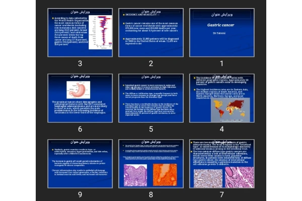 اورپوینت Gastric cancer