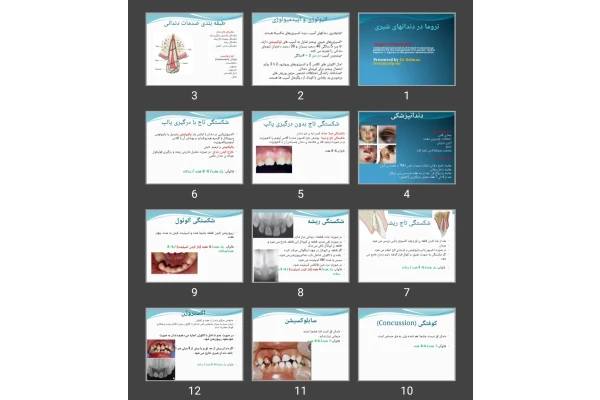 پاورپوینت تروما در دندان های شیری