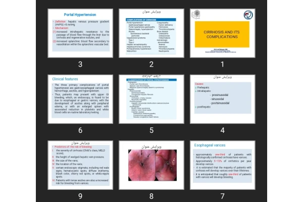 پاورپوینت CIRRHOSIS AND ITS COMPLICATIONS