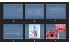 پاورپوینت منو نوکلئوز عفونی، زونا