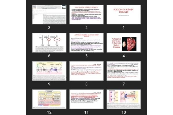 پاورپوینت POLYCYSTIC KIDNEY DISEASES