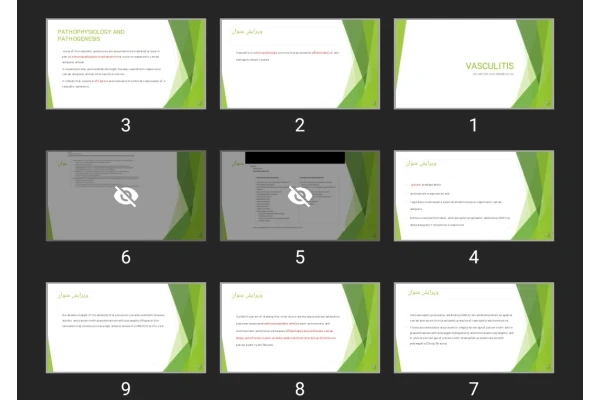 پاورپوینت VASCULITIS